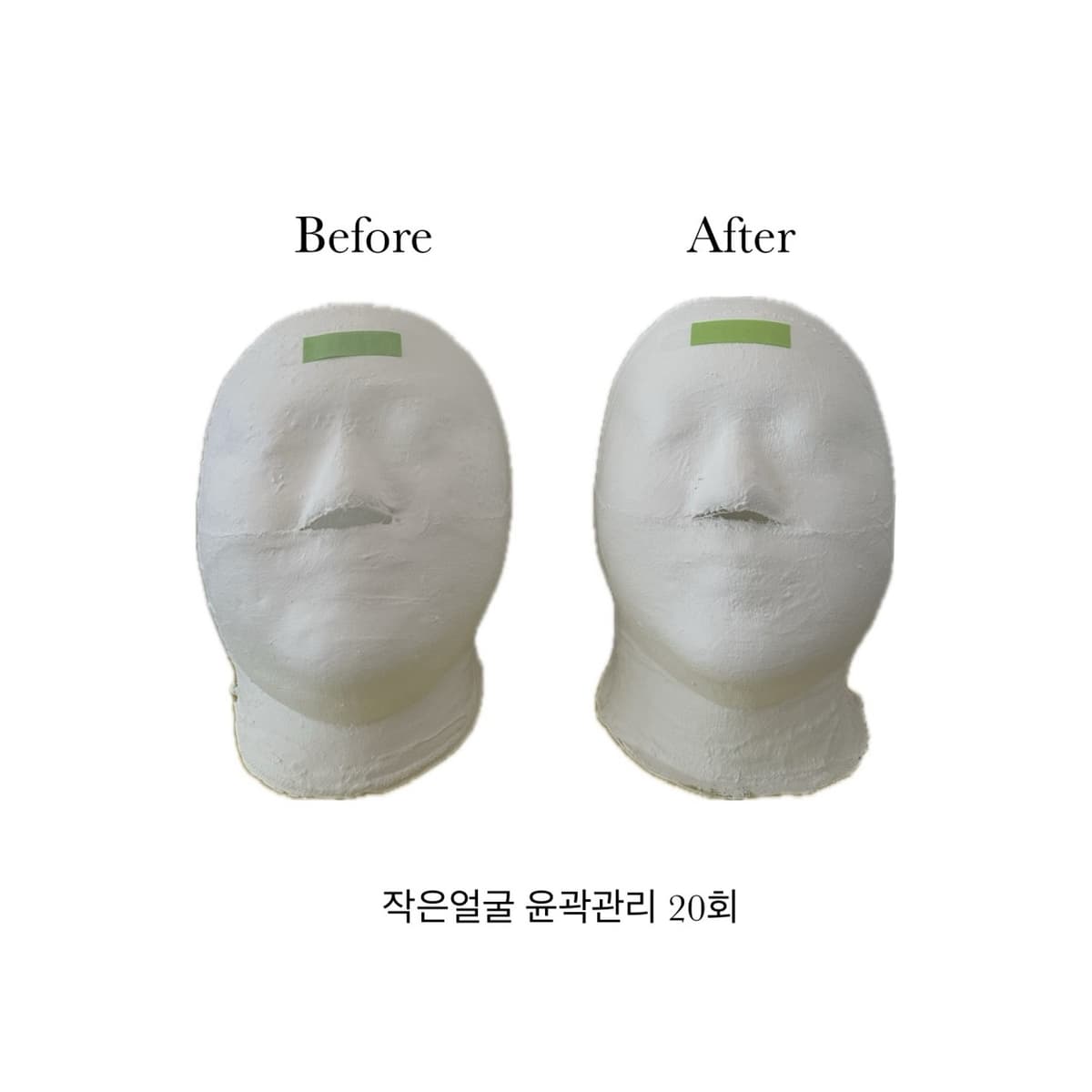 작은얼굴 윤곽관리 20 sessions