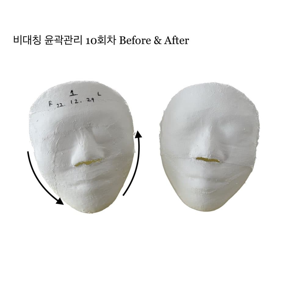 비대칭 윤곽관리 10 sessions