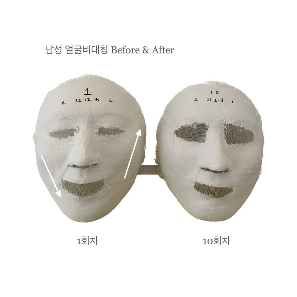 남성 얼굴비대칭 10 sessions