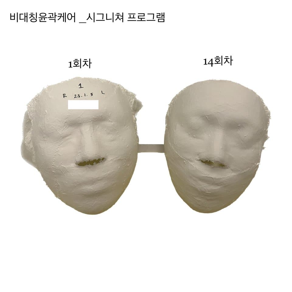 시그니쳐 윤곽케어 14 sessions