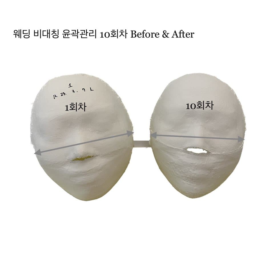 웨딩 비대칭 윤곽관리 10 sessions